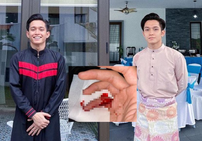 Gara-gara alat senaman tak henti hayun, Haikal Farid alami kecacatan pada jari kelingking – “Berdarah sampai kena sembilan jahitan” – Hiburan | mStar_609f518b32a21.jpeg
