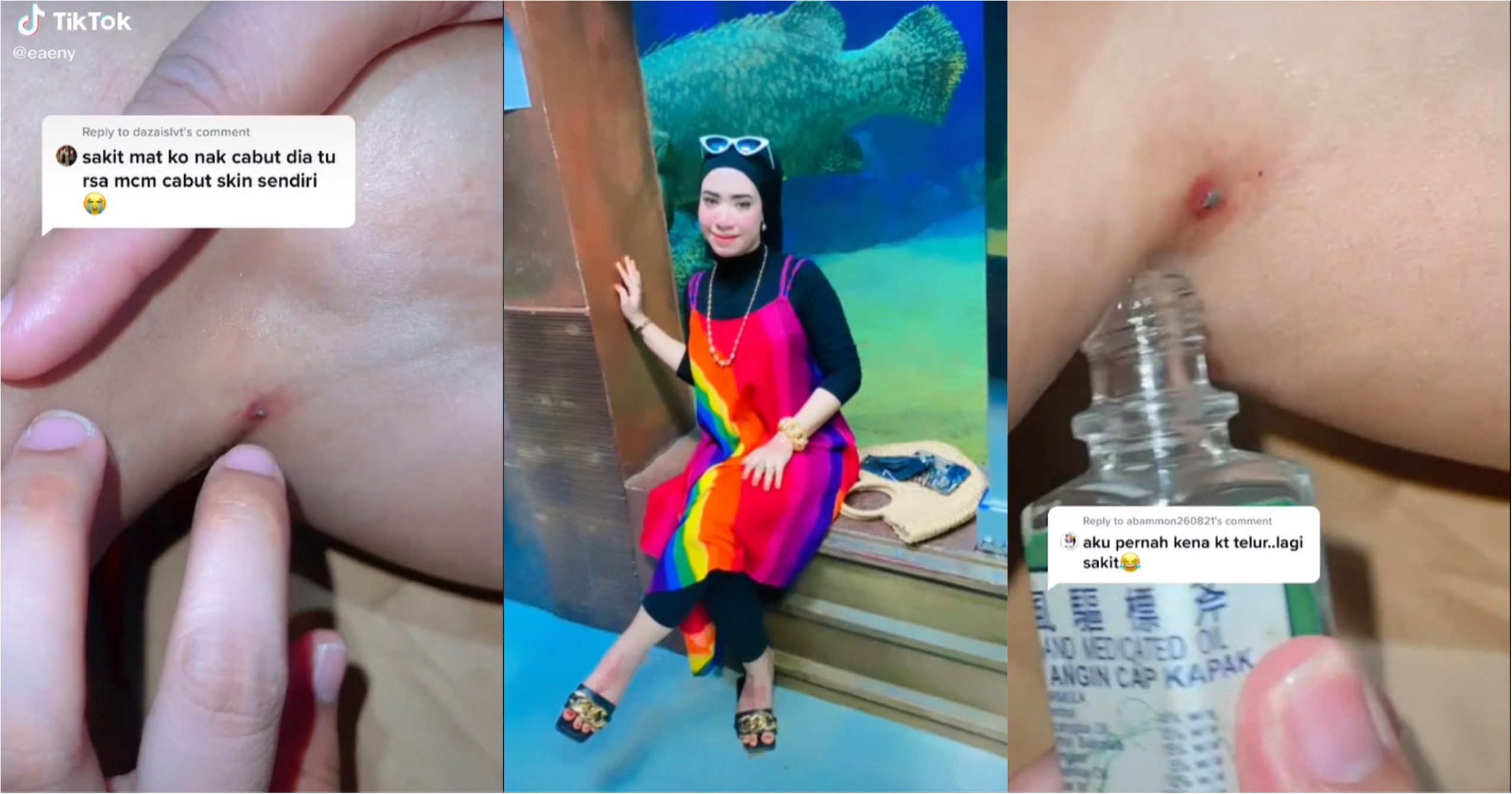 Apa yang dit4kuti wanita ini jadi nyata, kali ke-3 dig1git sengkenit sampai dem4m! Puncanya masih mist3ri – “P4rut dig1git tahun lepas pun belum hilang”_61ad91171e35d.jpeg