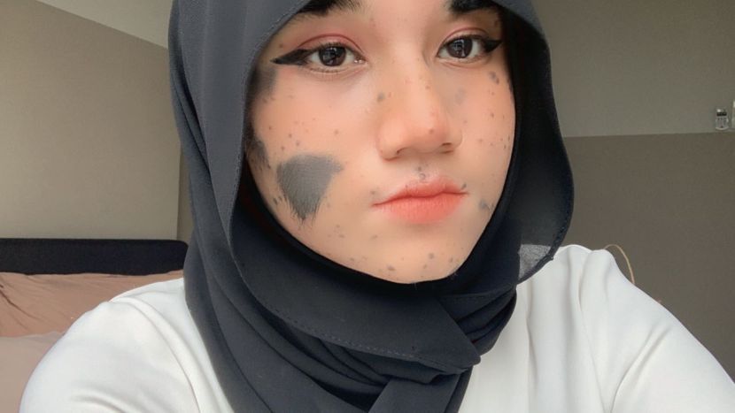 birth mark 1