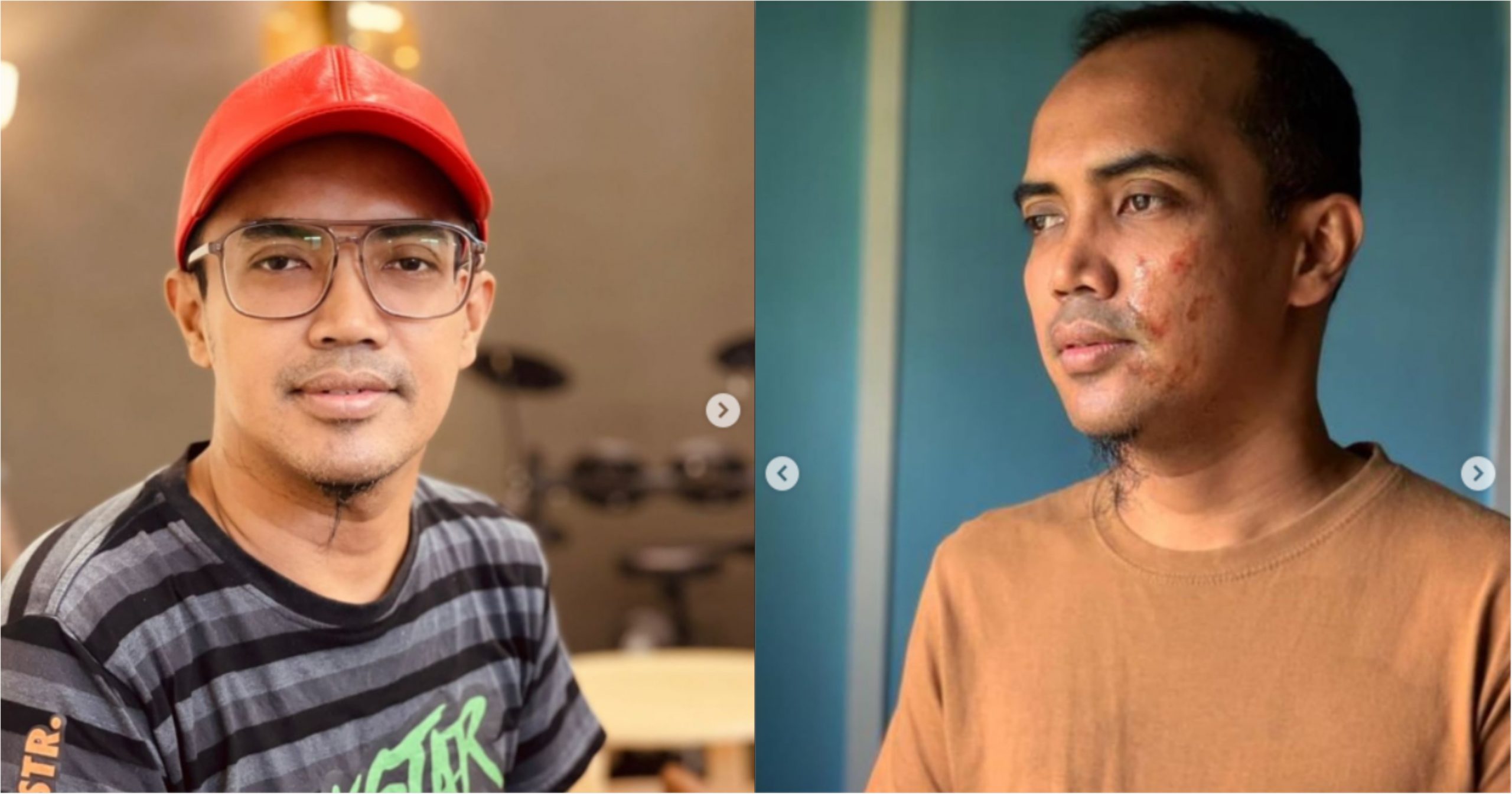 “Ada Yang Sampai N4ngis, Siap Doakan Saya Cepat Sembuh,” – Peminat Ris4u Tengok Muka Ezad Lazim_626a212ce4781.jpeg