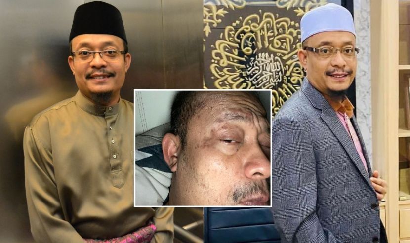 Alami lvka, berdar4h secara tiba-tiba… Kazim Elias akhirnya bercerita tentang peny4kit m1sterinya_6285a6e62c9cd.jpeg